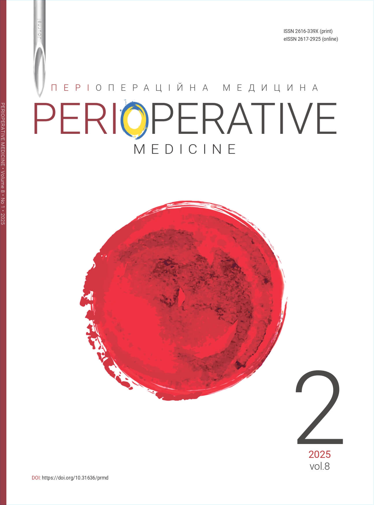 Perioperative Medicine 2025 vol 8 #2